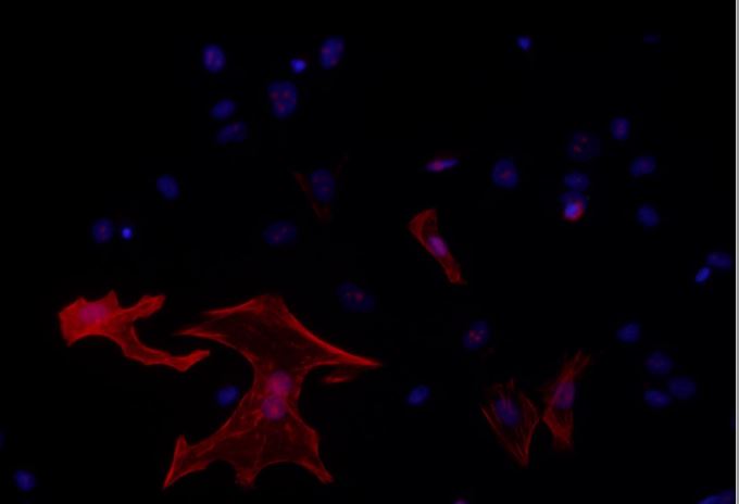 Lees meer over het artikel Engineering Maturity of Human Induced Pluripotent Stem Cell Derived Cardiomyocytes